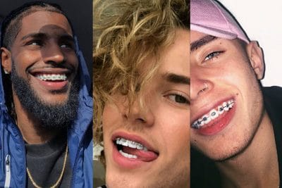 Best Braces Colors For Guys