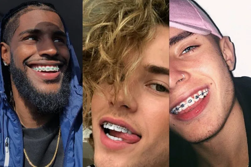 Best Braces Colors For Guys