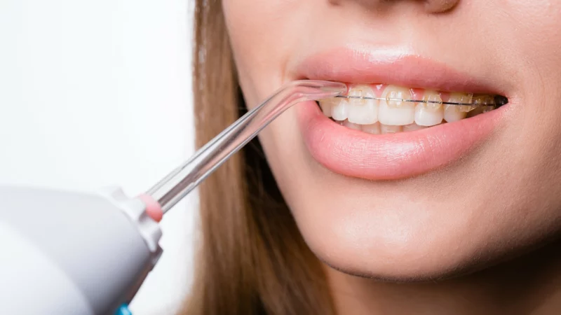 Best Water Flosser For Braces