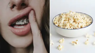 Can You Eat Popcorn With Braces