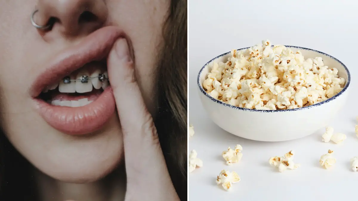 Can You Eat Popcorn With Braces? The Popcorn Predicament + 7 BETTER