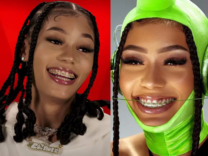 Coi Leray Gets Her Braces Off! Were Coi Leray's Gold Braces Real? 3 Coi Leray Braces - Gold Braces