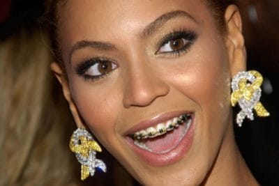 Did Beyonce Have Braces?