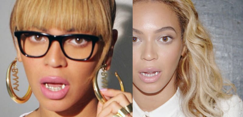 Did Beyonce Have Braces? - The Truth + Proof! 4 Did Beyonce Have Braces - Beyonce With Grillz