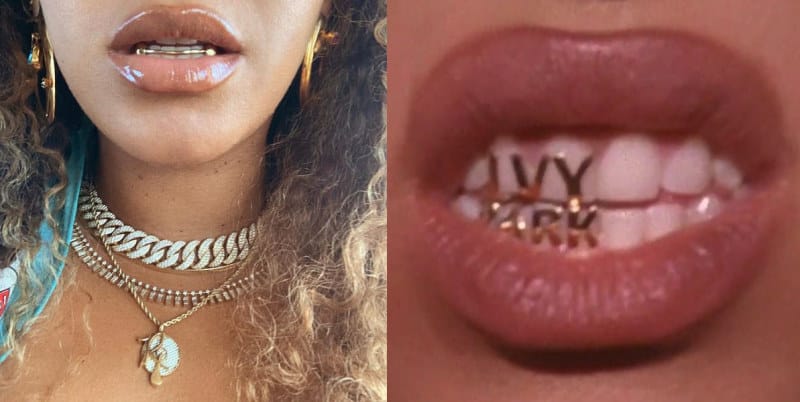 Did Beyonce Have Braces? - The Truth + Proof! 5 Did Beyonce Have Braces - Beyonce With More Grillz