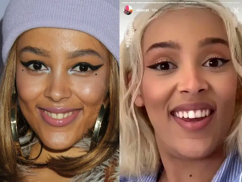 Doja Cat's Teeth Before and After Veneers + SERIOUSLY Bad Dental Hygiene 2 Doja Cat Teeth Before Veneers