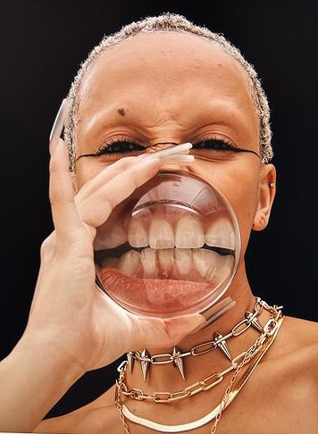 Doja Cat's Teeth Before and After Veneers + SERIOUSLY Bad Dental Hygiene 5 Doja Cat Teeth Now 2