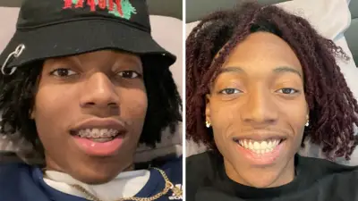 Lil Tecca Braces Journey