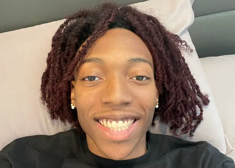 Does Lil Tecca Still Have Braces? How Lil Tecca's LONG Braces Journey Ended 2 Lil Tecca Gets His Braces Off
