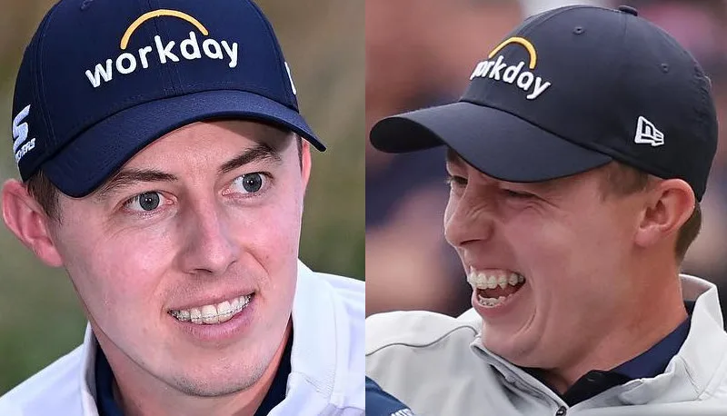 Does Matt Fitzpatrick Have Braces? See The US Open Winner's Adult Braces! 2 Matt Fitzpatrick Braces Matt Fitzgerald Adult Braces